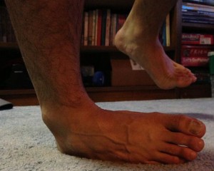 sprained-ankle